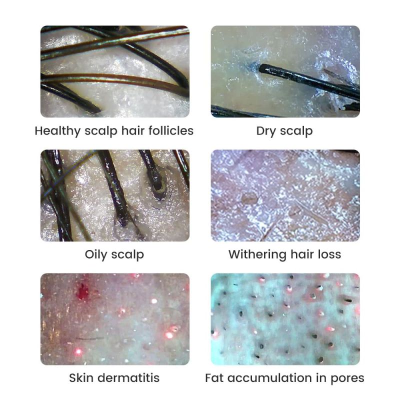 Digitalt Mikroskop 500x Forstørrelse | 2MP Kamera Hudanalysator Elektronikkreparasjon Videokamera