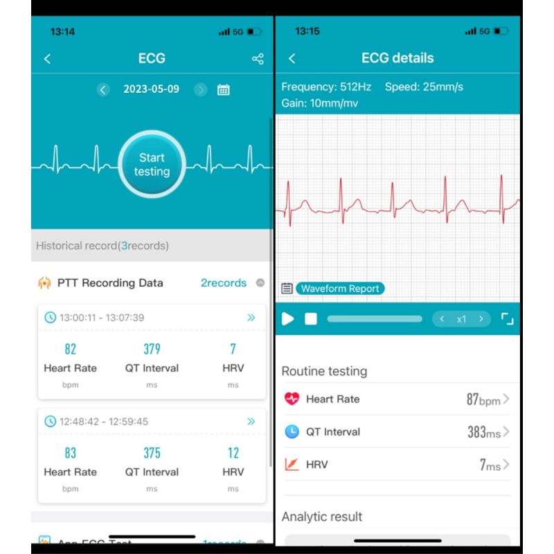 Smartklokke ET540 m/EKG, Blodsukker, Blodtrykk, Blodoksygen, Hjertefrekvens & Fitness Tracker for Kvinner
