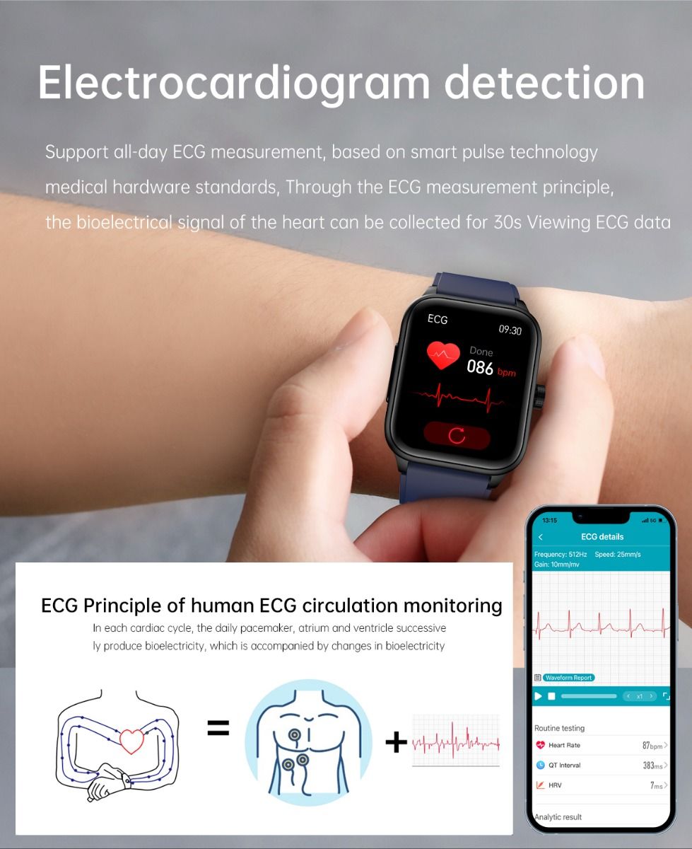 ET540 Blodsukker EKG Kroppstemperatur Blodtrykk Blodoksygen Hjertefrekvens Bluetooth-anrop Smartklokke Treningsmåler