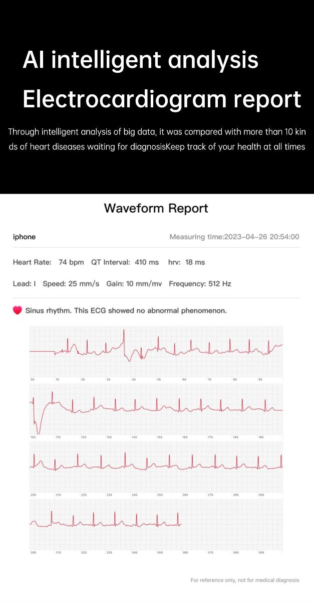 ET540 Blodsukker EKG Kroppstemperatur Blodtrykk Blodoksygen Hjertefrekvens Bluetooth-anrop Smartklokke Treningsmåler