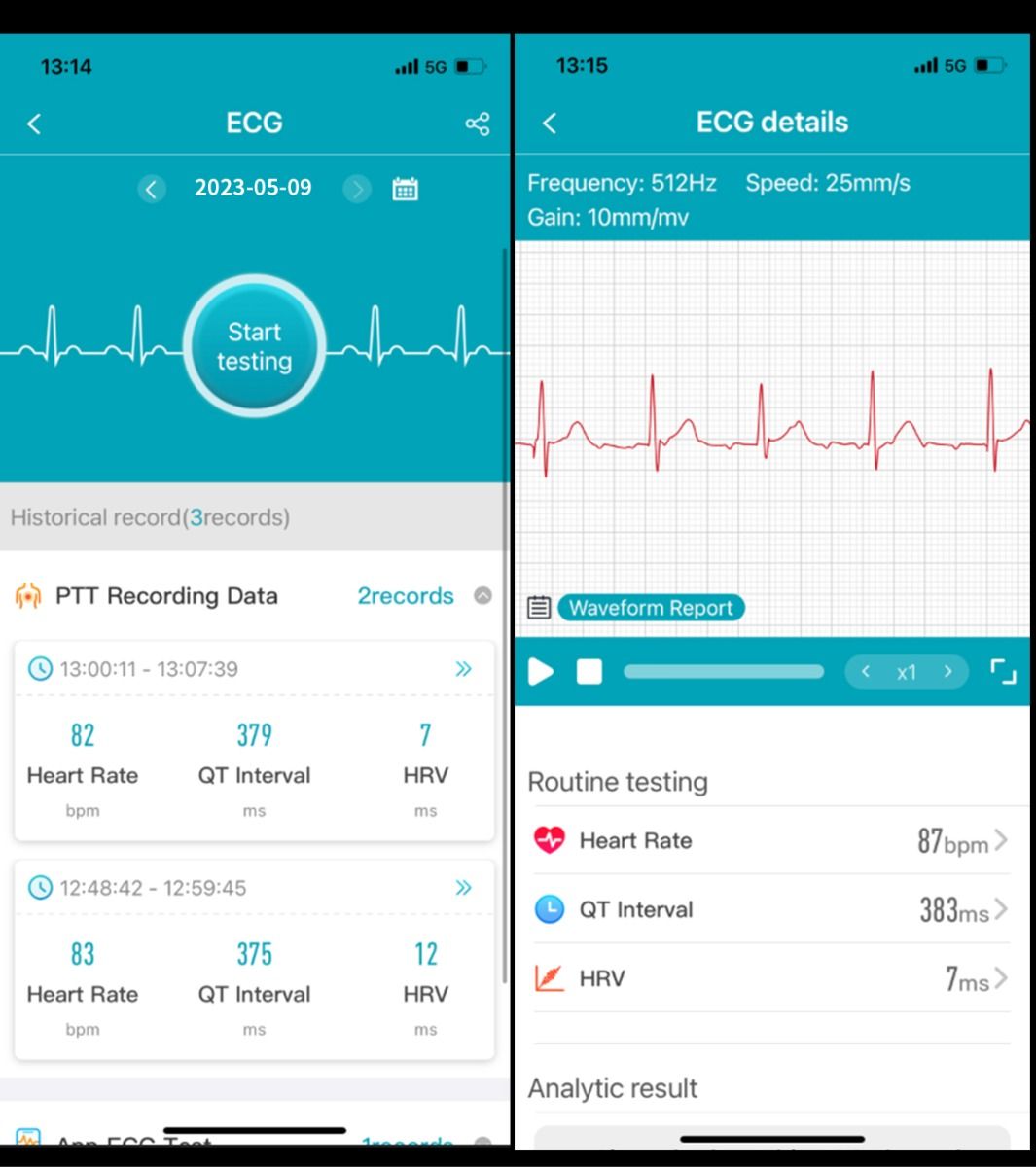 ET540 Blodsukker EKG Kroppstemperatur Blodtrykk Blodoksygen Hjertefrekvens Bluetooth-anrop Smartklokke Treningsmåler